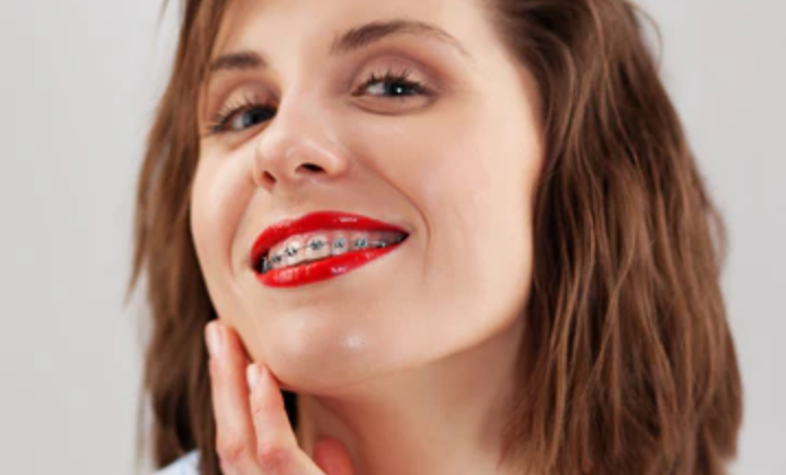adult teeth straightening treatments